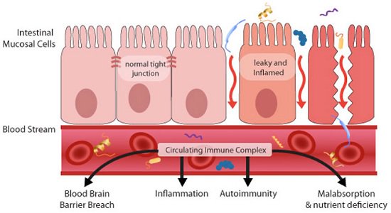 Permeabilidad Intestinal