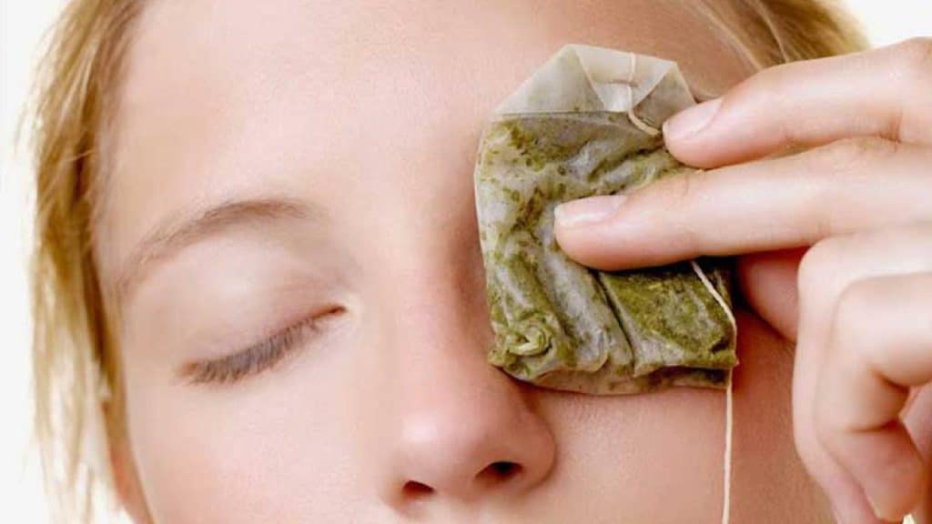 Evitar y eliminar las ojeras